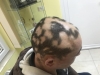 dermatologie timisoara