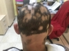 dermatologie timisoara