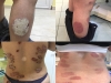 dermatologie timisoara